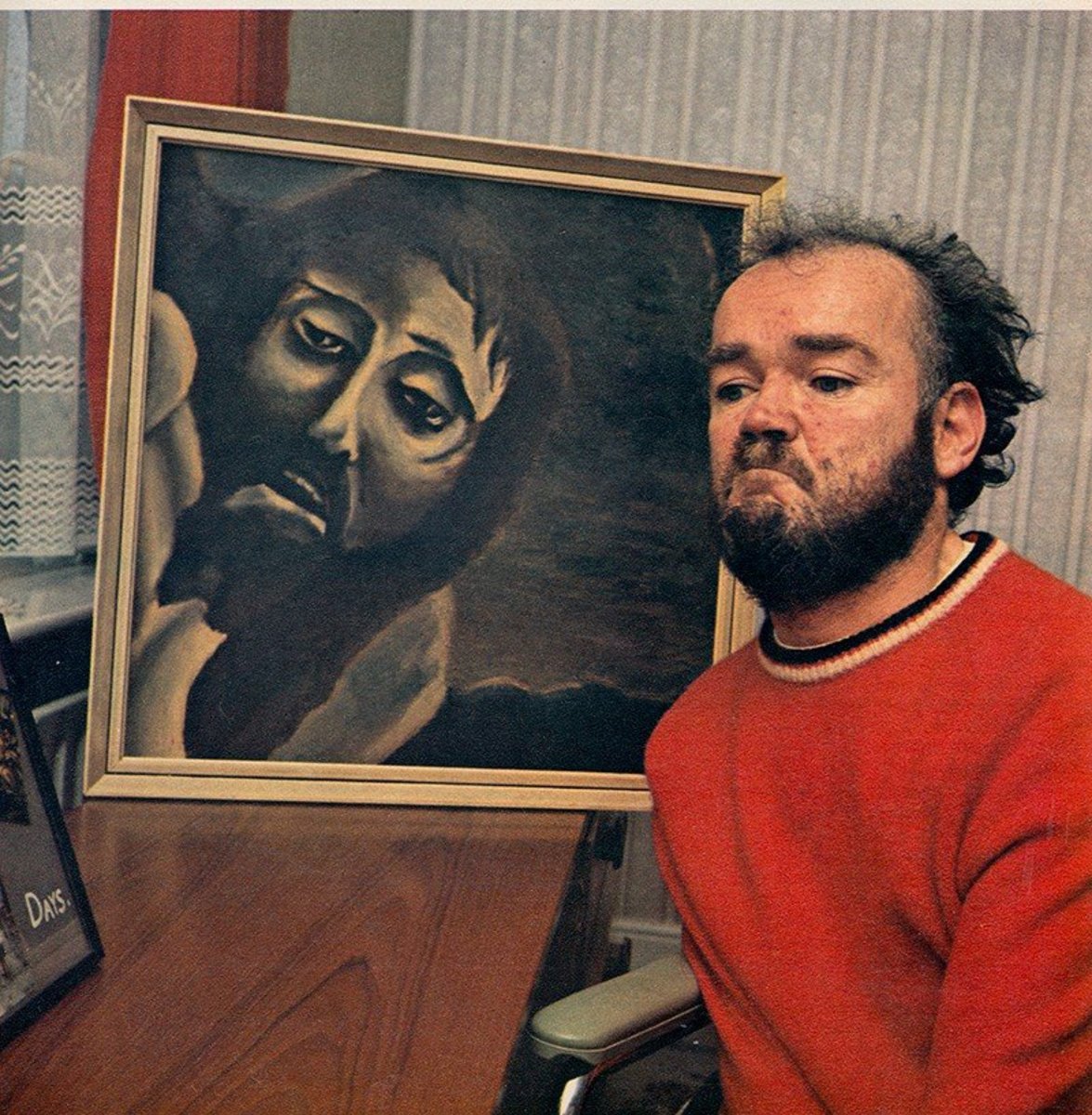 christy-brown-the-novelist-and-painter-with-cerebral-palsy-depicted-in-the-movie-my-left-foot-1-1715778134.jpg