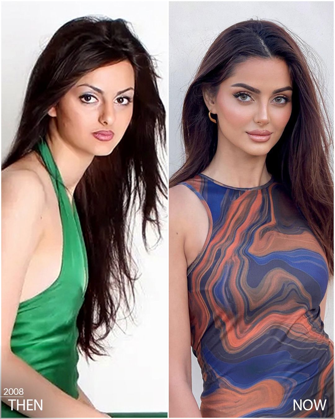 rate-mahlagha-jaberi-before-and-after-plastic-surgery-v0-2g3m50bam8fc1-1768409806.jpg