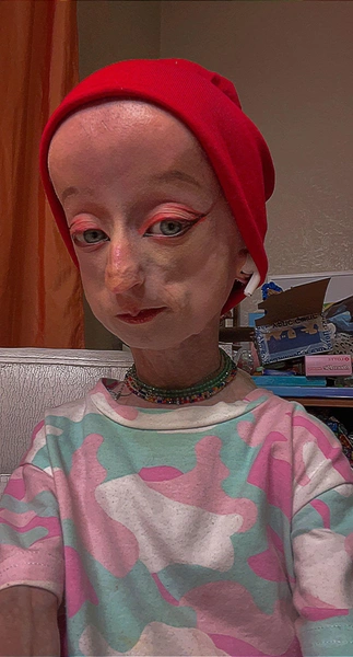 progeria5-1773850526.png