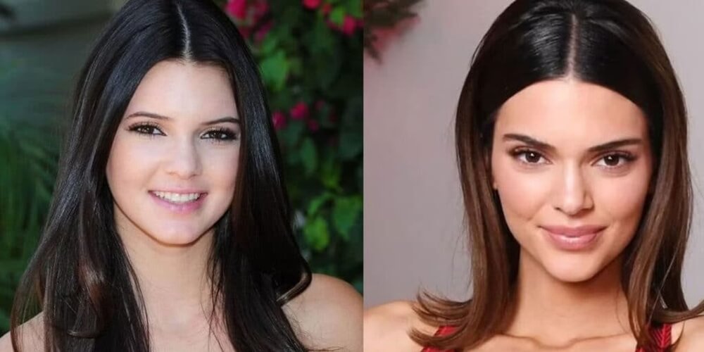 kendall-jenner-plastic-surgery-the-truth-behind-her-natural-yet-refined-look-03-1776864039.jpg