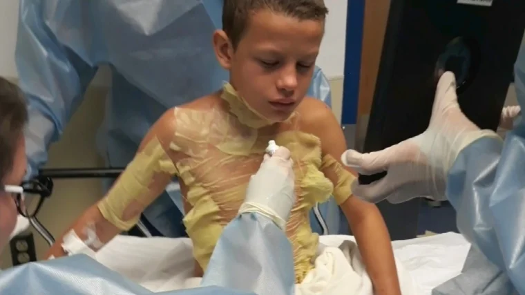 191003-jason-cleary-burn0victim-wdiv-ac-1029p-1781686249.webp